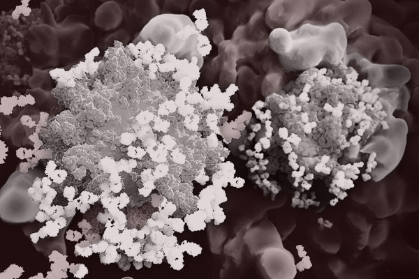 Autoantibodies as Biomarkers for Cutaneous Melanoma
