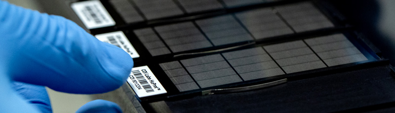 HuProt Proteome Protein Microarray